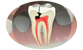 05-servicos-endodontia