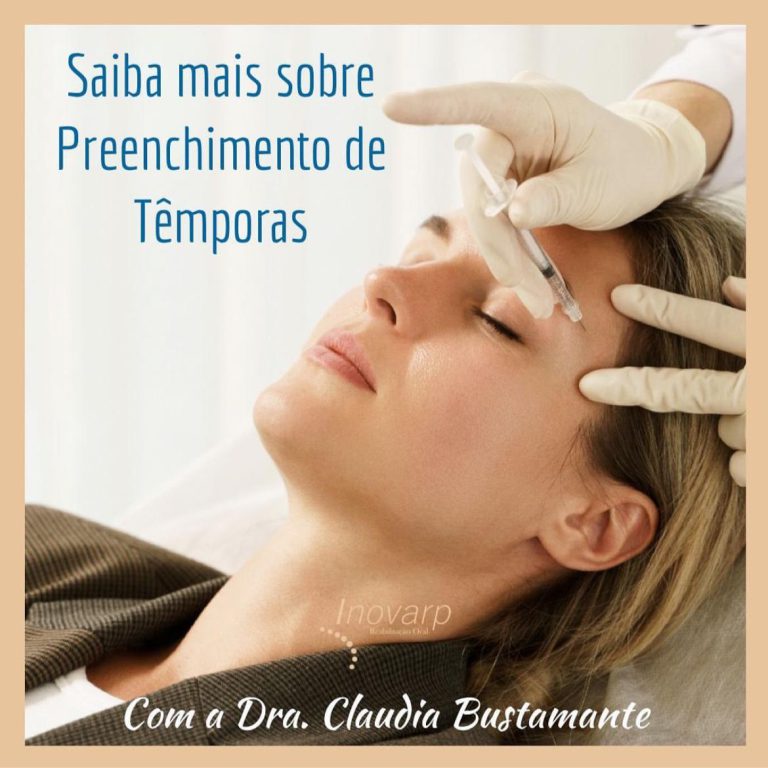 Preenchimento De T mporas Inovarp Dra Claudia Bustamante preenchimento-de-t-mporas-inovarp-dra-claudia-bustamante